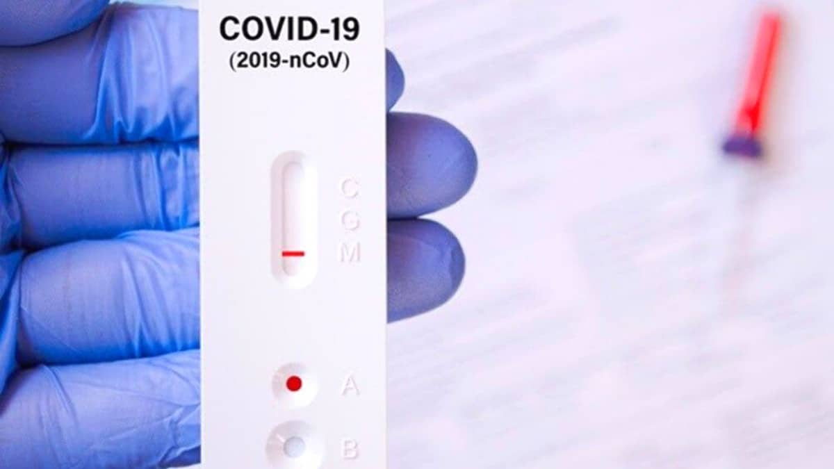 test covid 19 farmaceuticos